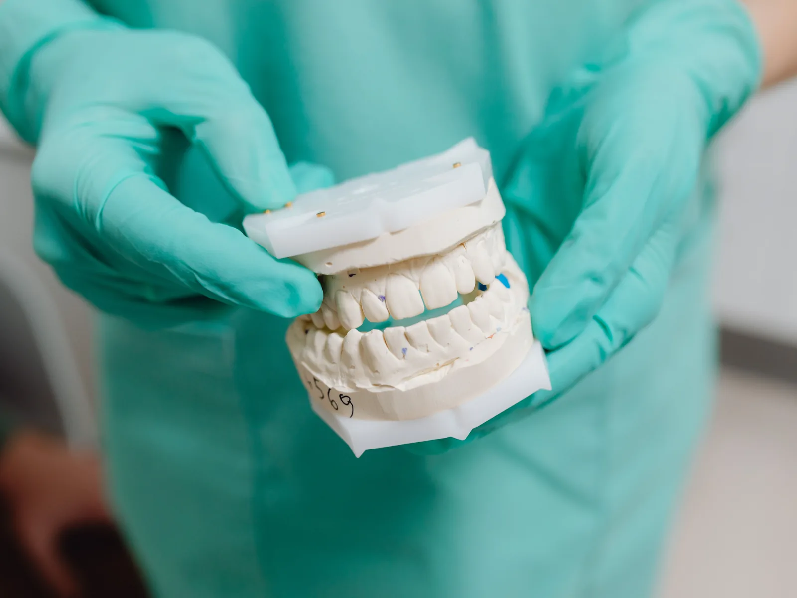 Gipsowy model zębów w pracowni techniki dentystycznej